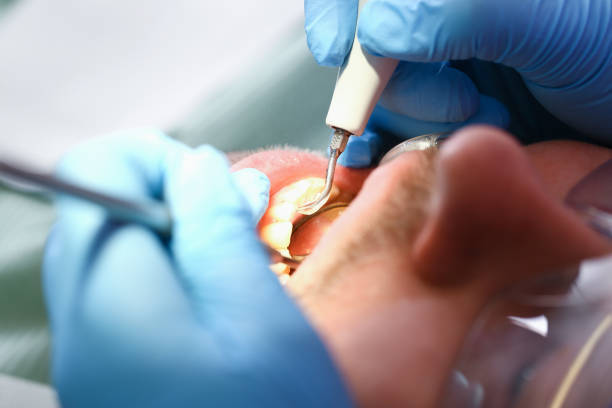 Best Same-Day Emergency Dental Services in Mount Pleasant, NC