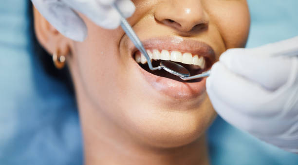 Best Emergency Gum Treatment in Mount Pleasant, NC